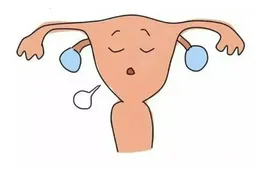 有鞍状子宫可以自然怀孕吗，必要时可以尝试辅助生殖技术