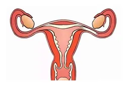 调经促孕丸可以治多囊卵巢吗，具体用药方案都写在这里了