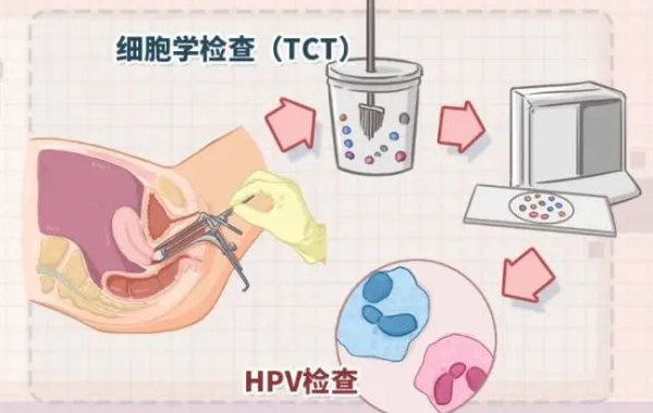 tct异常可以做试管婴儿