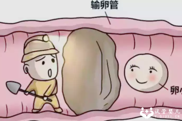 输卵管堵塞做手术后怀孕几率会变高吗？