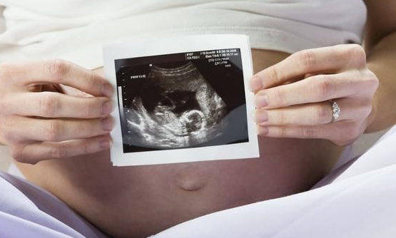 怀男孩孕早期最准最全的7大症状，从妊娠线和肚子以下就看出来了