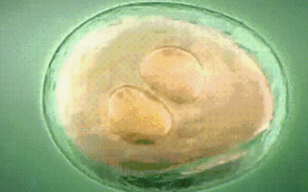 冻胚移植后1-14天变化情况，根据图片可清楚知道胚胎的变化