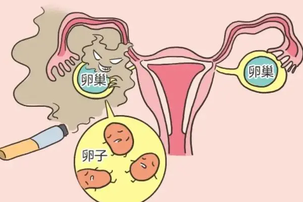 雌二醇高会增加卵巢刺激综合征风险