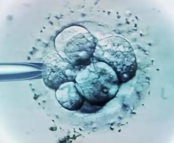 胚胎质量会影响HCG增长