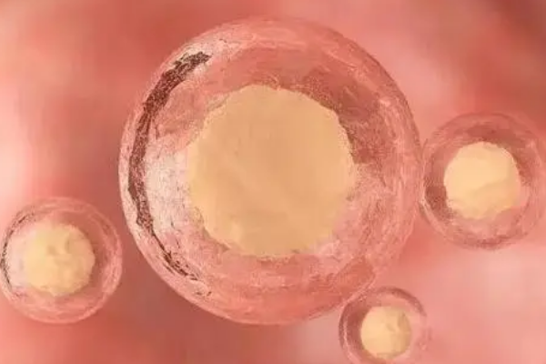 不剧烈运动可防止排卵