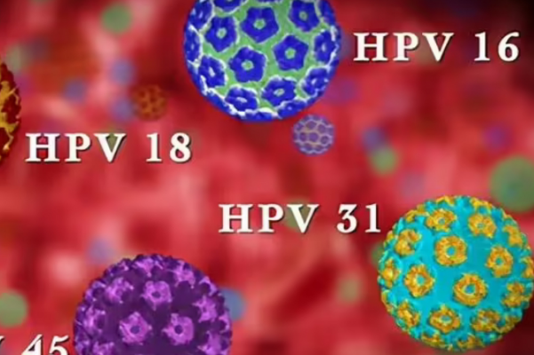 高危型hpv会降低成功概率