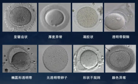 卵子透明带胶冻状有希望