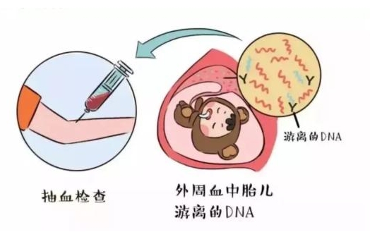 试管无创dna不容易高风险