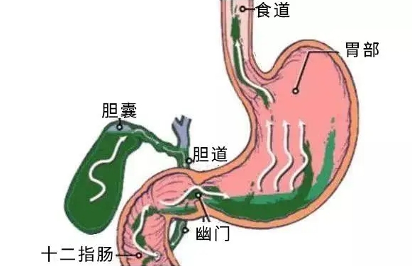 胆囊不舒服影响试管移植